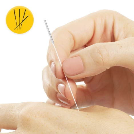 Akupunkturní jehly s trubičkou 100 ks. 0,3 x 60 mm