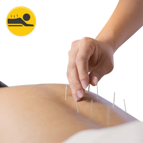 Akupunkturní jehly s trubičkou 100 ks. 0,25 x 30 mm