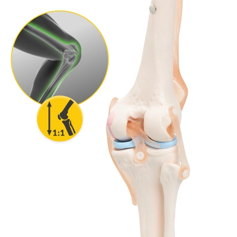 Anatomický model kolenního kloubu