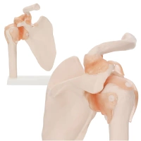 LIFE-SIZE SHOULDER JOINT