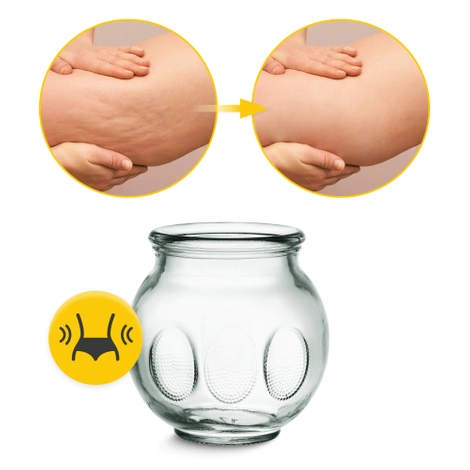 Čínské baňky vakuové 20 ks.