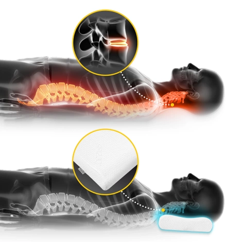 Ortopedický polštář ERGO SMALL